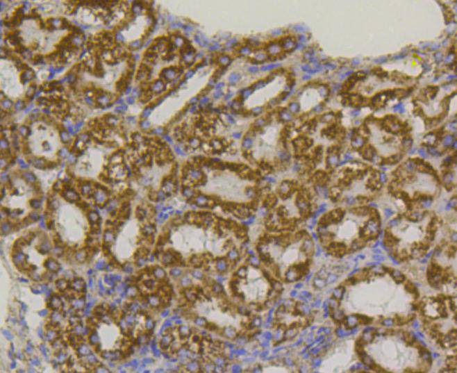 Anti-VDAC1 Antibody (9P313)