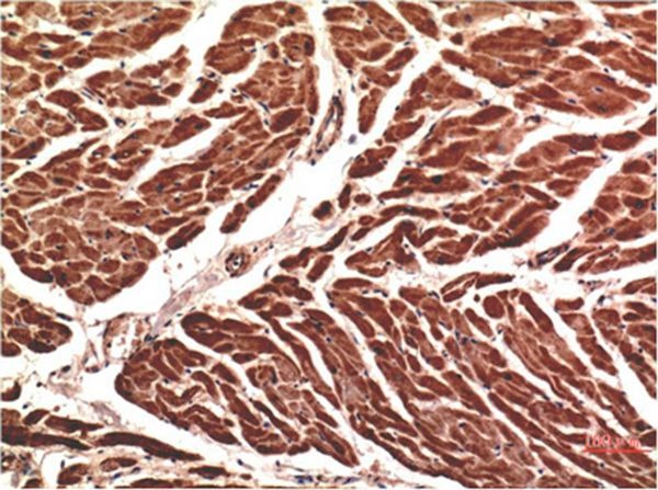 Anti-VE-Cadherin Antibody (2Q629)