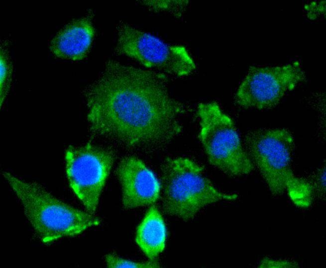 Anti-VEGFA Antibody (8D813)