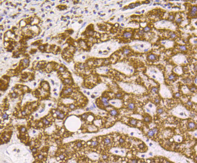 Anti-VDAC1 Antibody (9P313)