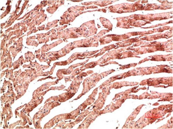 Anti-VE-Cadherin Antibody (2L788)