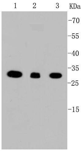 Anti-VDAC1 Antibody (9P313)
