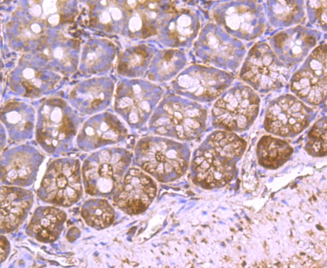 Anti-VCP Antibody (3I403)