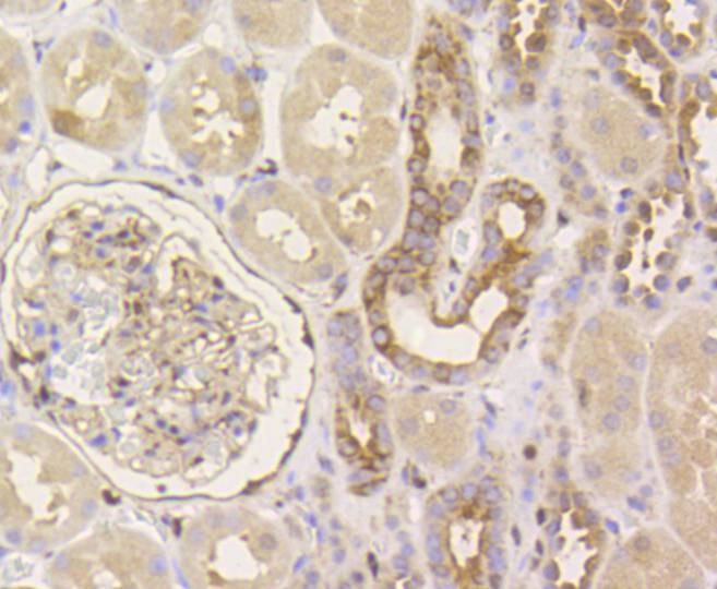 Anti-YAP1 Antibody (7R366)