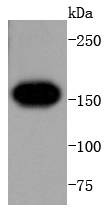 Anti-FLT1 Antibody (9B367)
