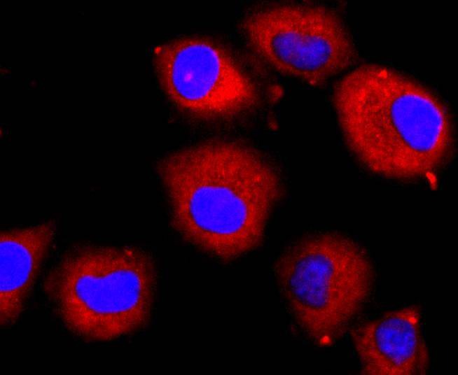 Anti-VEGFR2/KDR Antibody (1S897)