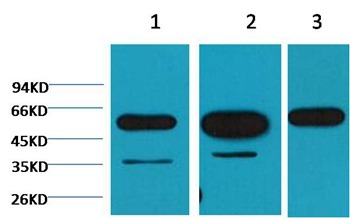 Anti-TUBB Antibody (7V738)