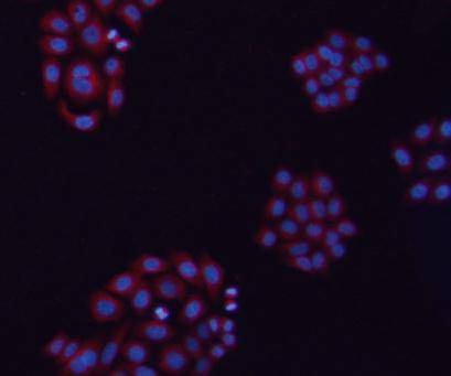 Anti-TUBB Antibody (8X869)