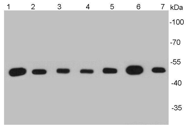 Anti-TUBB Antibody (8X869)