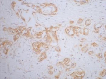 Anti-CTNNB1 Antibody (3Q677)