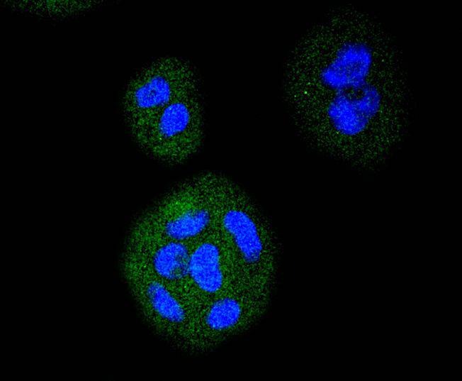 Anti-FLT1 Antibody (9B367)