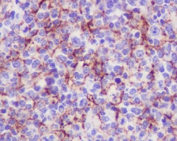 Anti-VCAM-1 Antibody (4M671)