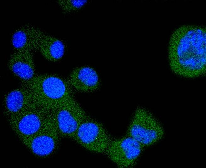 Anti-FLT1 Antibody (9B367)