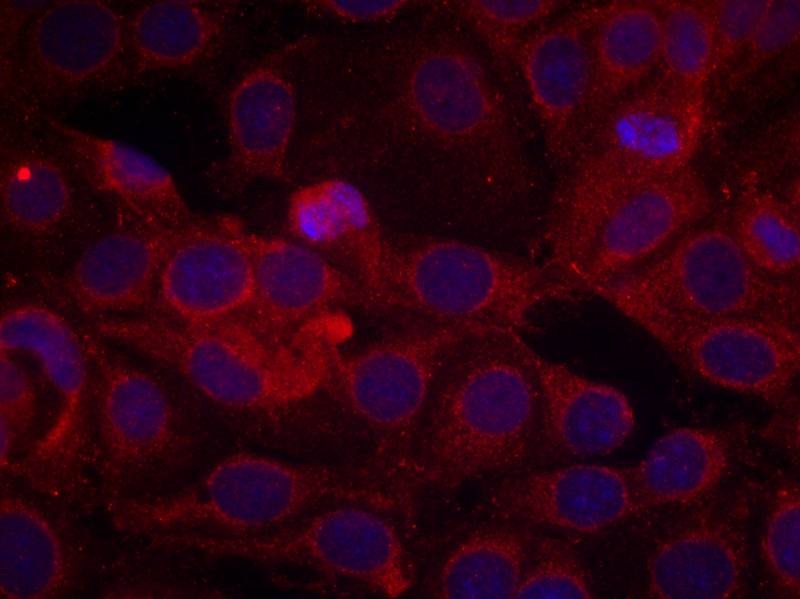 Anti-Phospho-VEGFR2/KDR (Tyr1175) Polyclonal Antibody 3