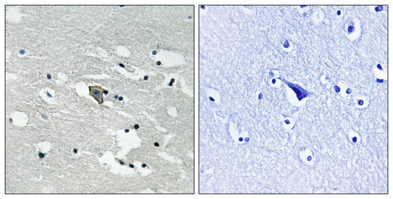Anti-Phospho-FLT1 (Tyr1048) Polyclonal Antibody
