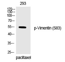 Anti-Phospho-Vimentin (Ser83) Polyclonal Antibody