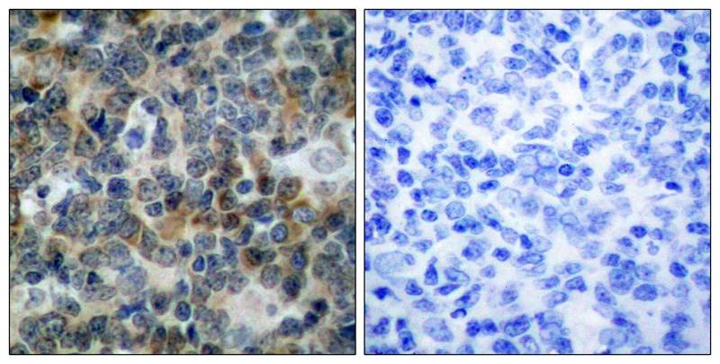Anti-Phospho-VASP (Ser239) Polyclonal Antibody