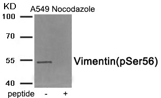 Anti-Phospho-Vimentin (Ser56) Polyclonal Antibody