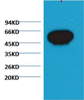 Anti-TUBB Antibody (2D560)