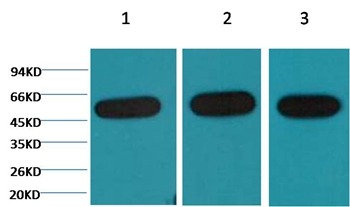 Anti-TUBB Antibody (7E229)