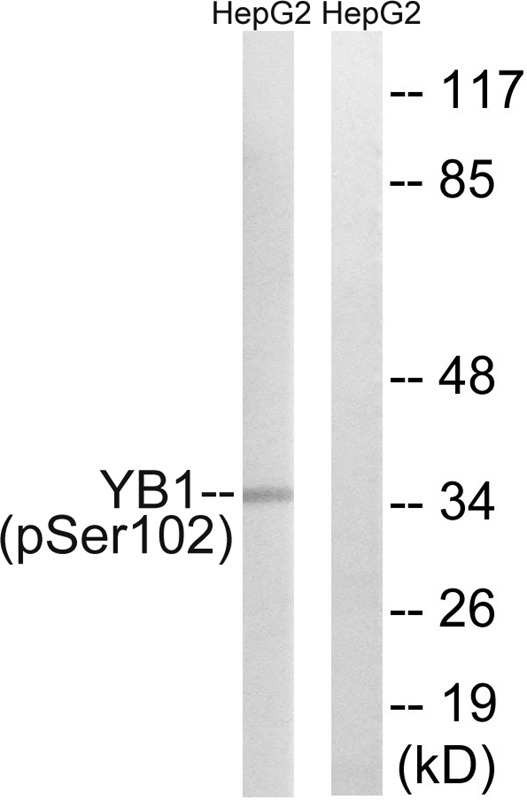 Anti-Phospho-YB1 (Ser102) Polyclonal Antibody