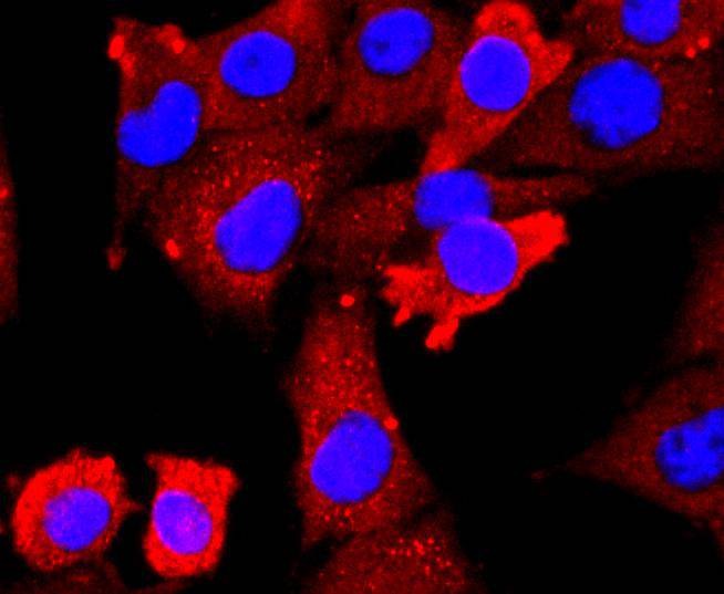 Anti-VEGFR2/KDR Antibody (1S897)
