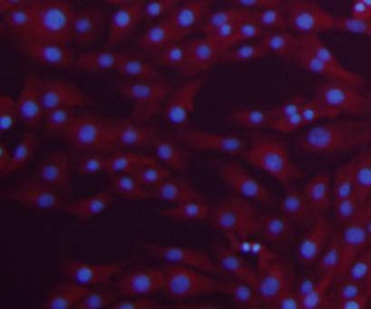Anti-TUBB Antibody (8X869)