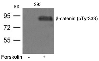 Anti-Phospho-CTNNB1 (Tyr333) Polyclonal Antibody