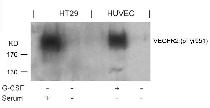 Anti-Phospho-VEGFR2/KDR (Tyr951) Polyclonal Antibody