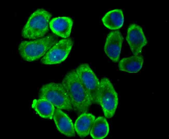 Anti-villin1 Antibody (7N900)