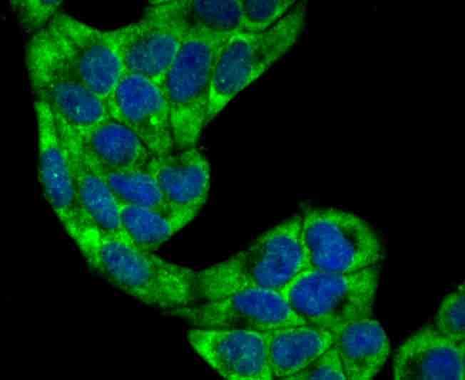 Anti-villin1 Antibody (7N900)