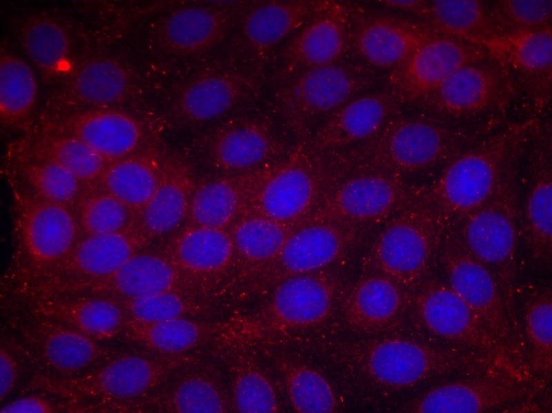 Anti-Phospho-VEGFR2/KDR (Tyr1214) Polyclonal Antibody