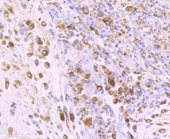Anti-IGF2/IGF-II Antibody (5T527)