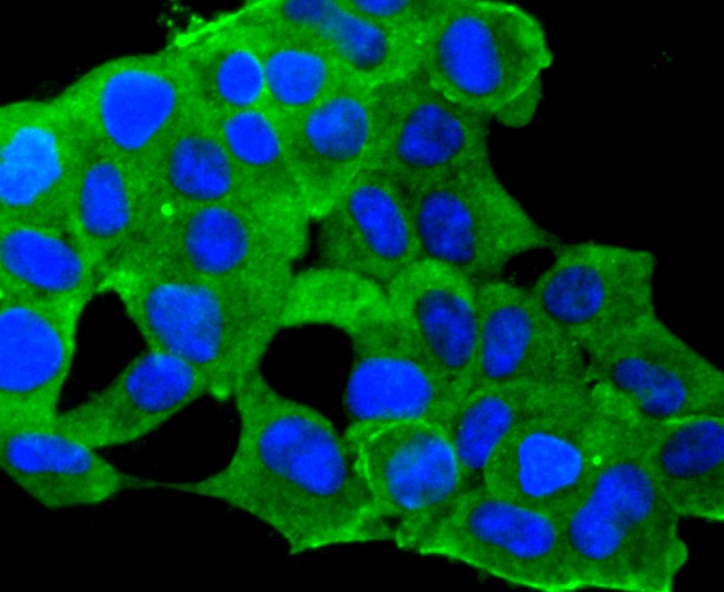 Anti-IGF2/IGF-II Antibody (5T527)