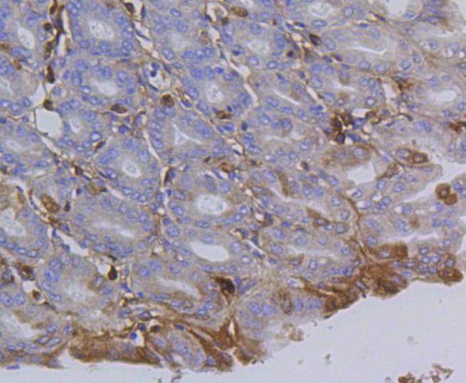 Anti-ITGB1 Antibody (1M683)
