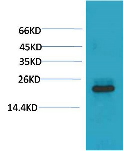 Anti-HSPB8 Antibody (4T230)
