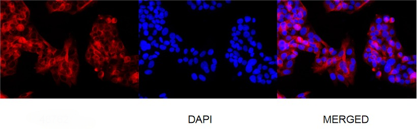 Anti-Integrin beta 3 Antibody (4P677)