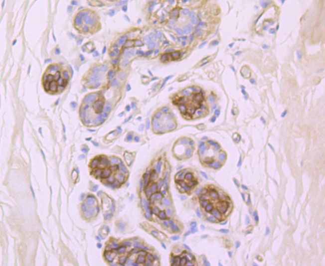 Anti-ITGB4 Antibody (3G397)