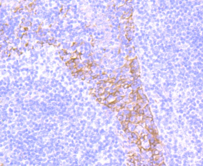 Anti-ITGB4 Antibody (3G397)