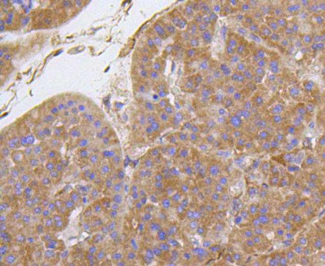 Anti-ITGB1 Antibody (1M683)