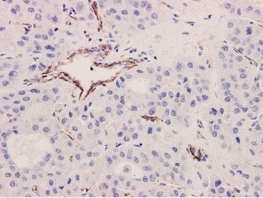 Anti-Integrin beta 3 Antibody (4P677)