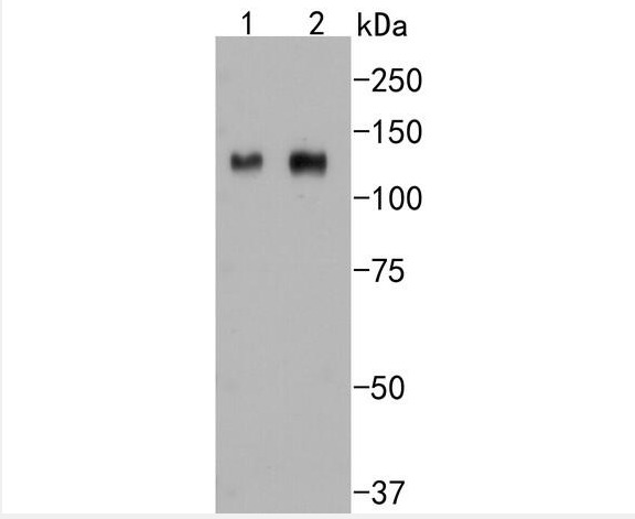 Anti-Integrin beta 3 Antibody (4P677)