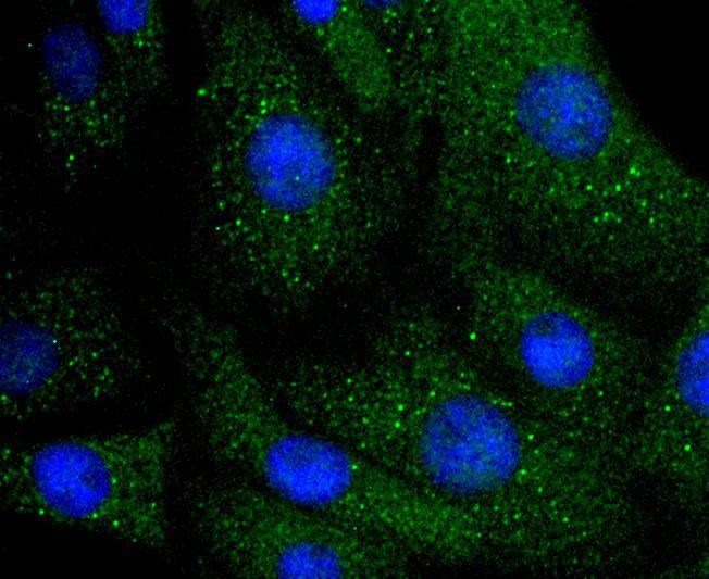 Anti-ILK Antibody (9I91)