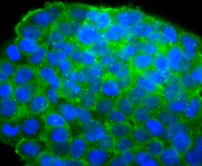 Anti-IGF2/IGF-II Antibody (5T527)
