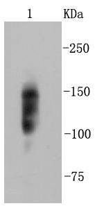 Anti-ITGB1 Antibody (1M683)