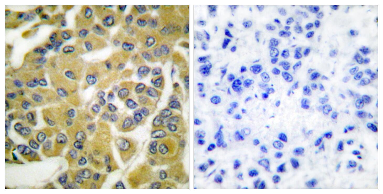 Anti-Phospho-IKBKB (Tyr188) Polyclonal Antibody