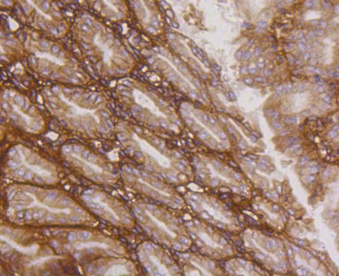 Anti-ITGB1 Antibody (1I859)