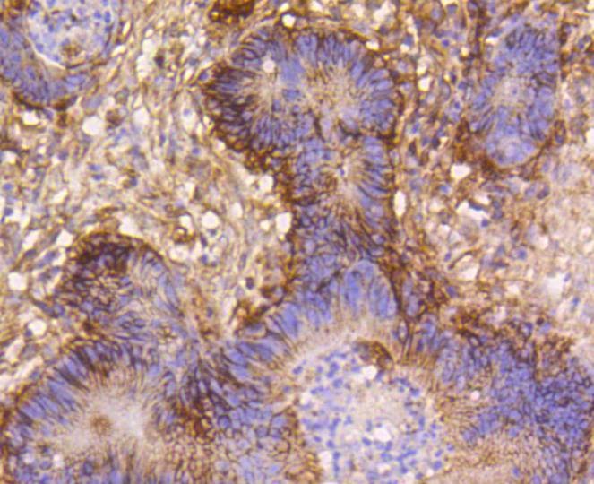 Anti-ITGB1 Antibody (1I859)