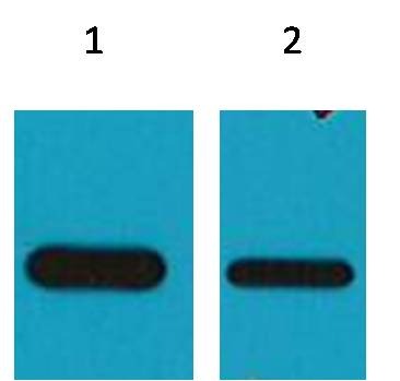 Anti-HSV Antibody (9X21)