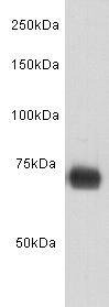 Anti-ALB Antibody (6W796)